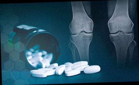 Achat arthrose medicament